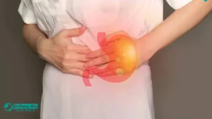 علاج قرحة المعدة
