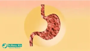 أعراض جرثومة المعدة