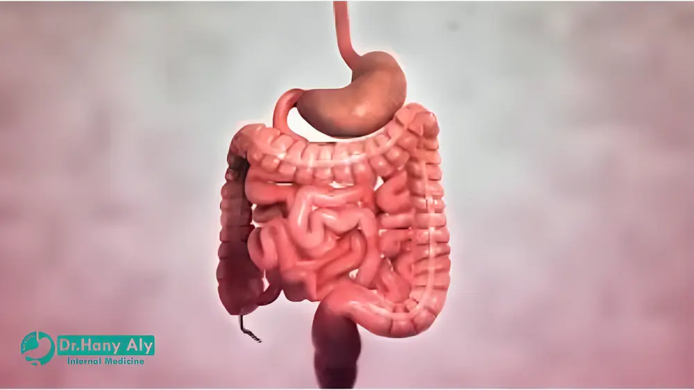 علاج مرض كرون