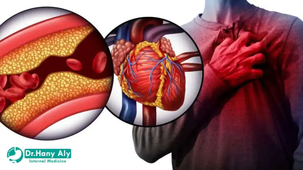 اعراض ارتفاع ضغط الدم