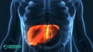 تجربتي في إزالة دهون الكبد