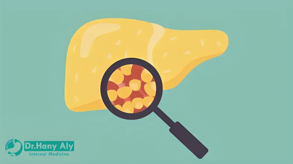 تجربتي في إزالة دهون الكبد