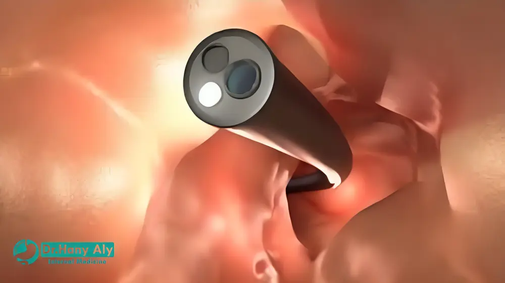 هل منظار القولون يحتاج تخدير كامل