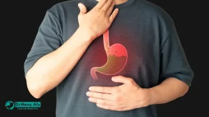 علاج ارتجاع المريء الصامت​