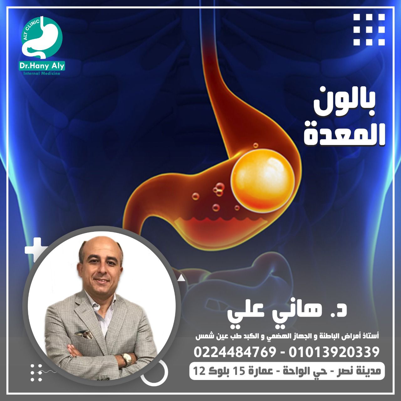 بالون المعدة للتخسيس