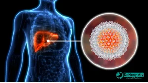 دكتور لعلاج فيروس سي