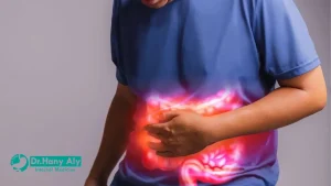 نسبة الشفاء من مرض كرون